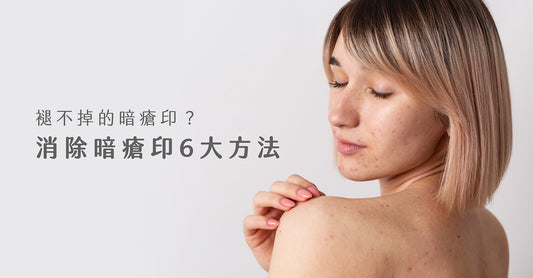 褪不掉的暗瘡印?消除暗瘡印6大方法 | Love Share Beauty