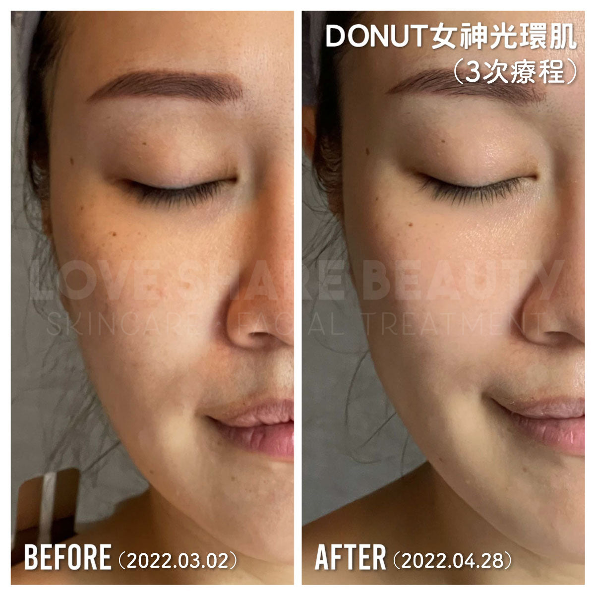 Donut 女神光環肌(單次)