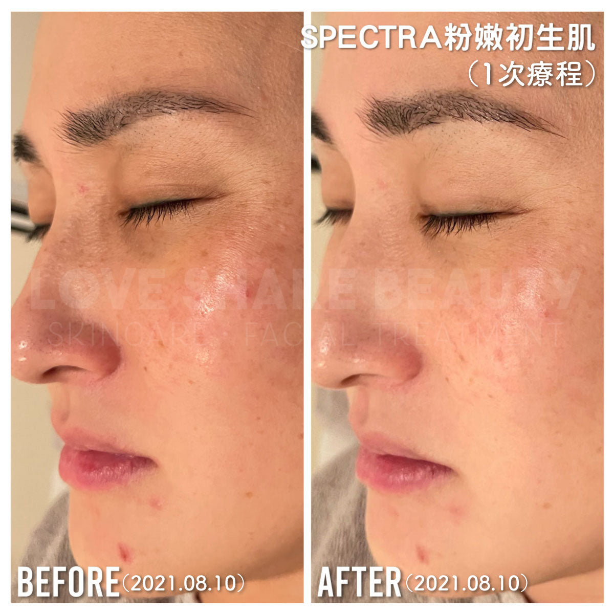 Spectra 粉嫩初生肌(單次)