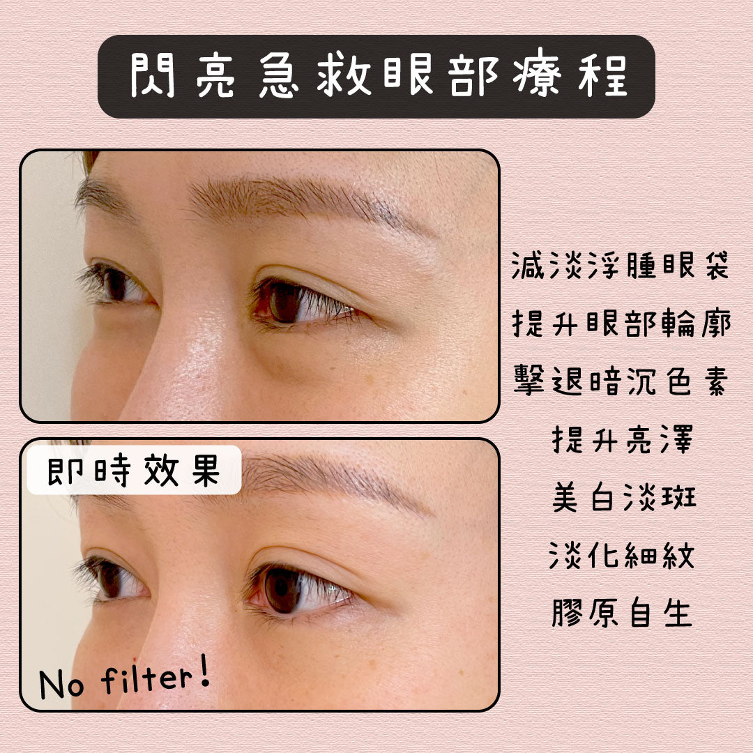 閃亮急救眼部療程(單次)