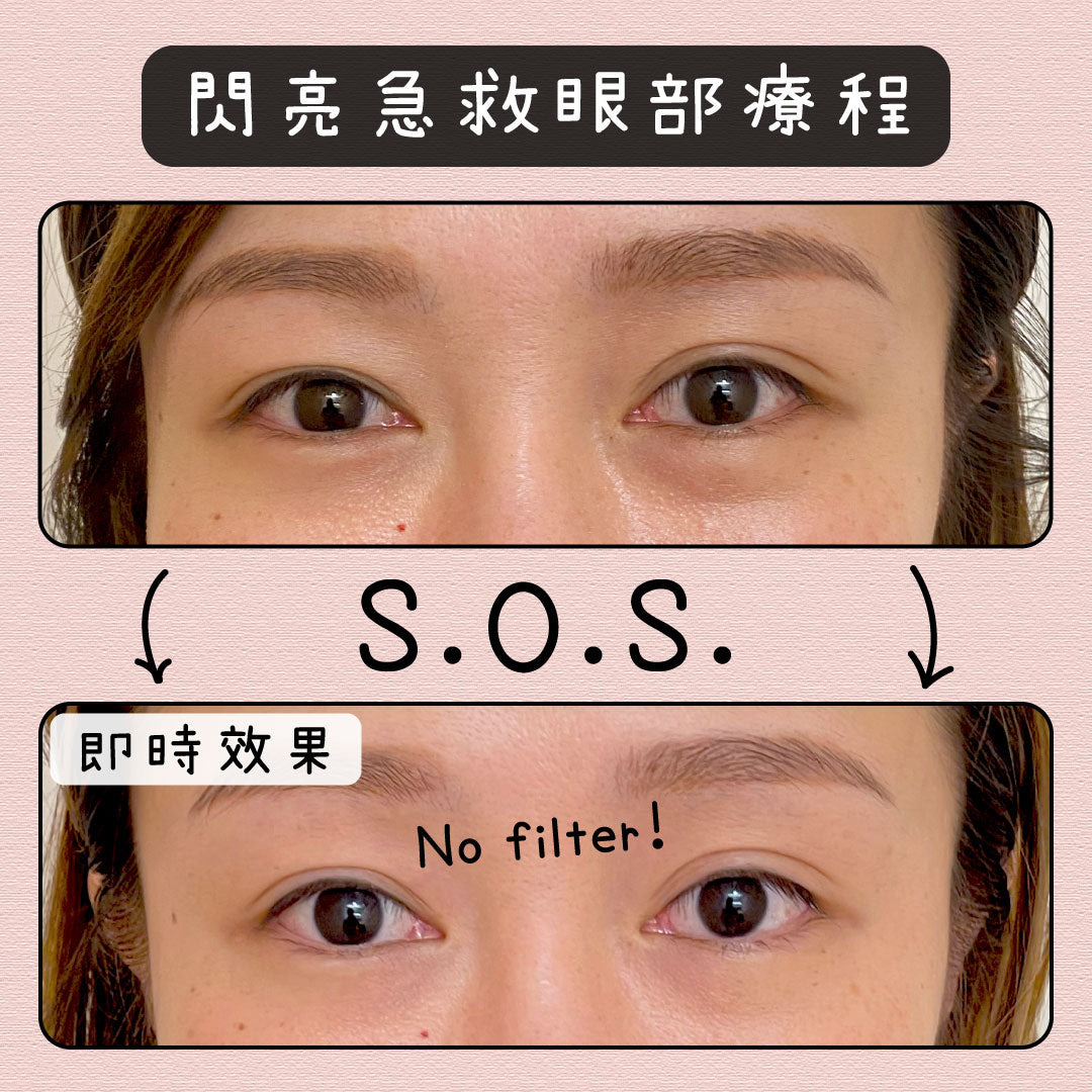 閃亮急救眼部療程(單次)