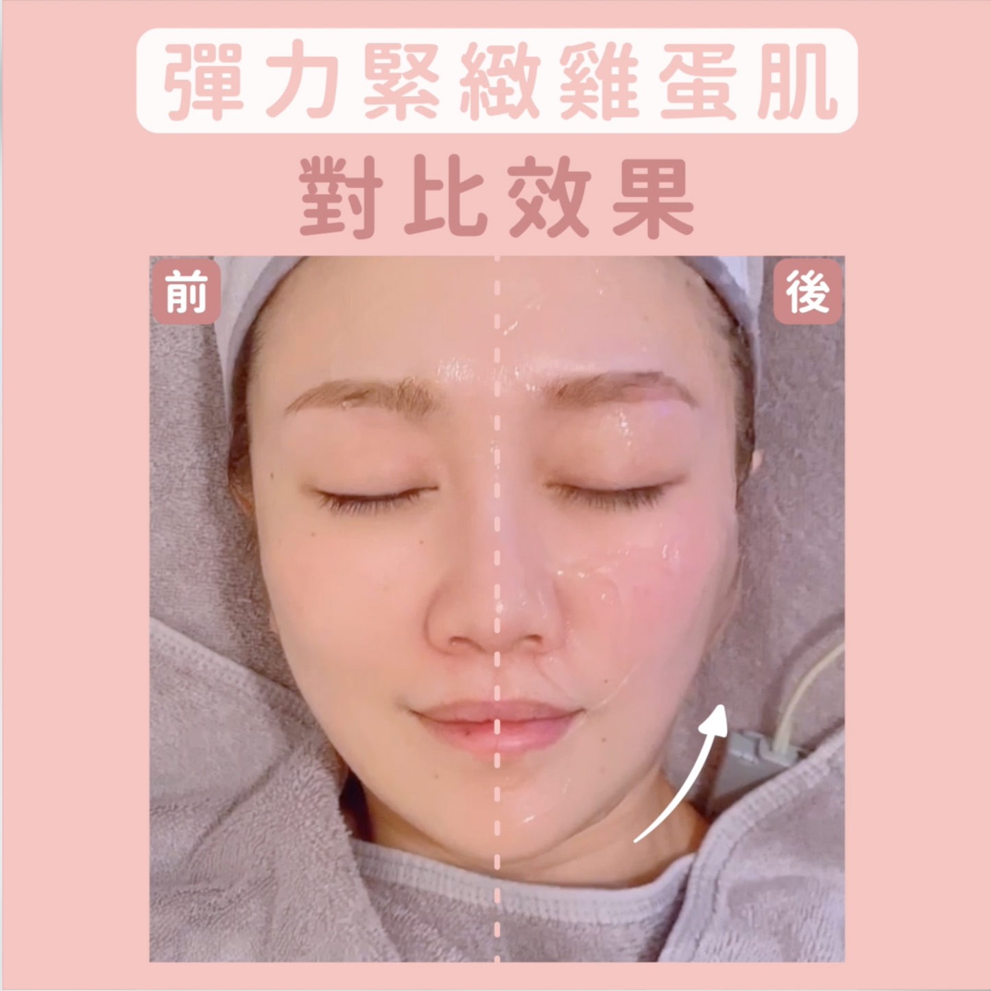 BTL彈力緊緻雞蛋肌療程(單次)